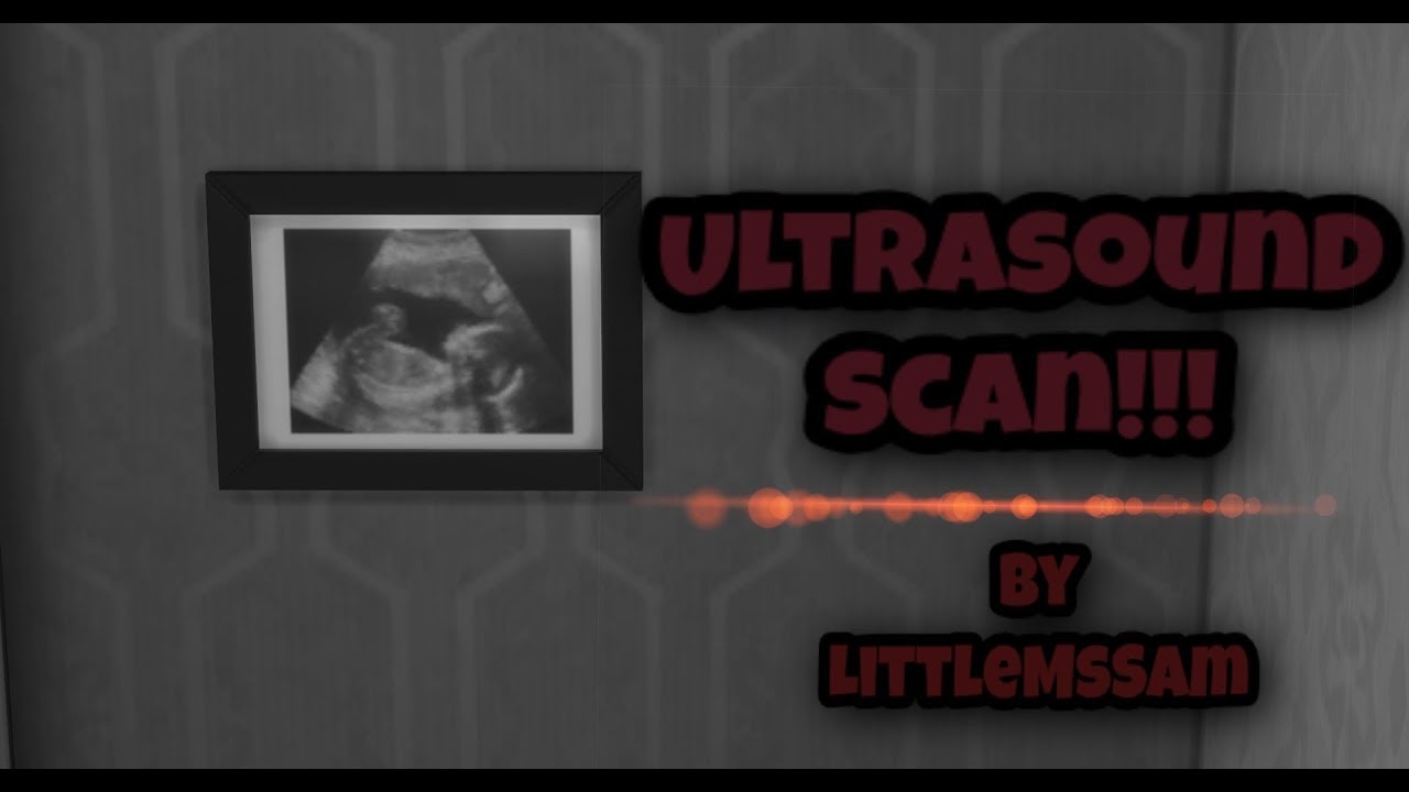 the sims 3 ultrasound mod